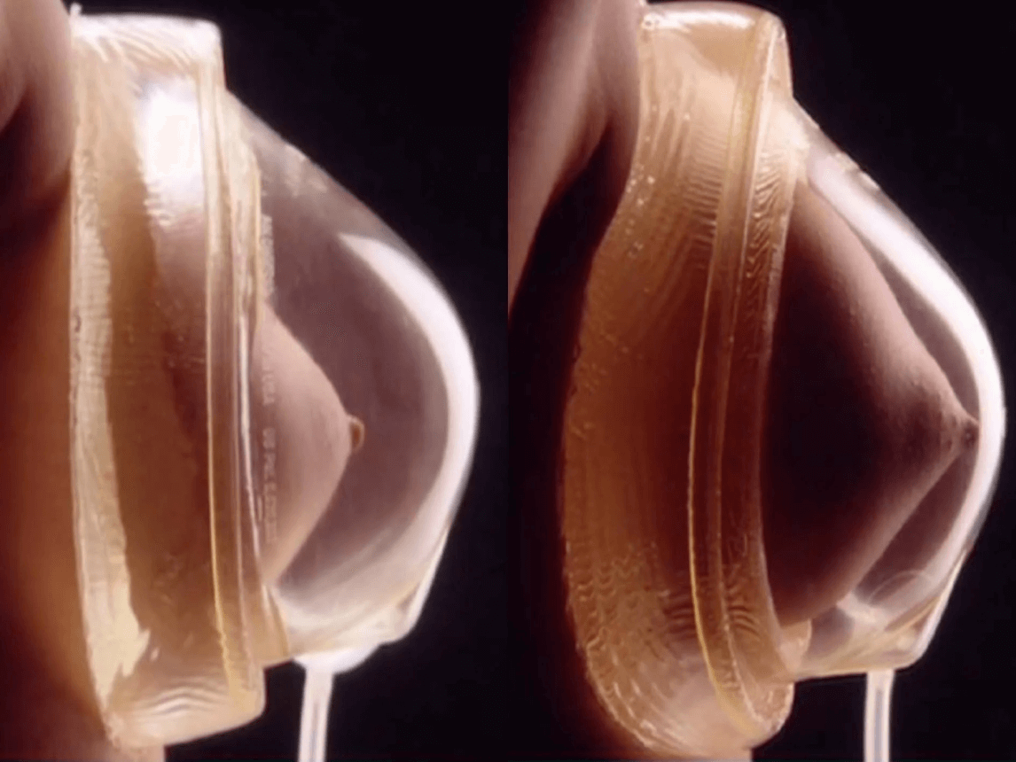 BRAVA enhancement device