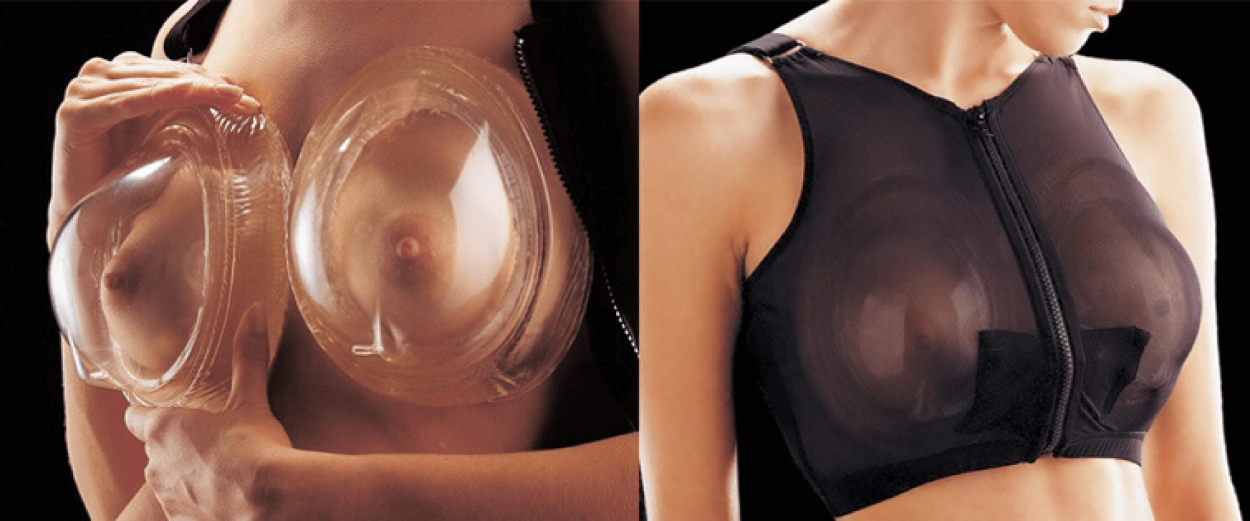 BRAVA breast enhancement and shaping system"