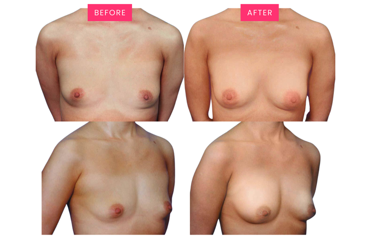 Original before-and-after comparison, image four