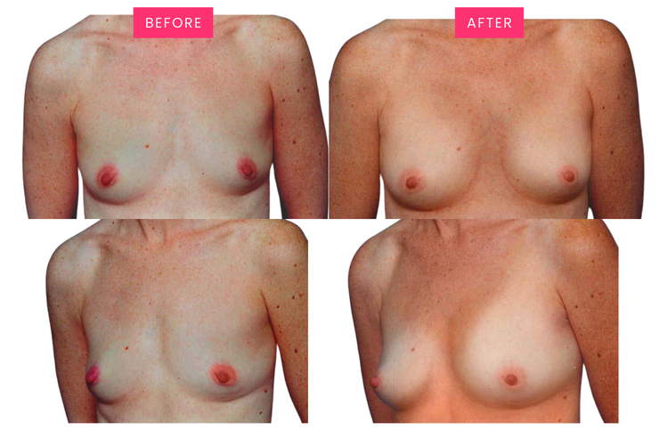 Original before-and-after comparison, image three