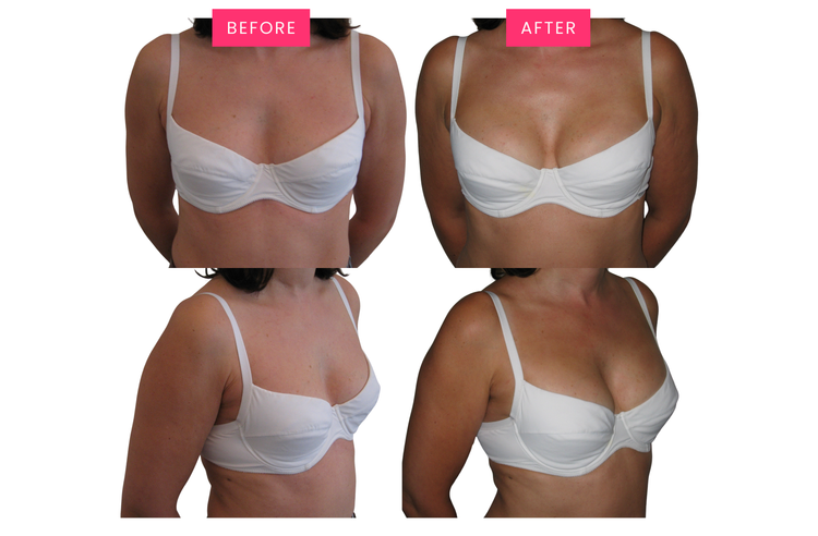 Original before-and-after comparison, image one