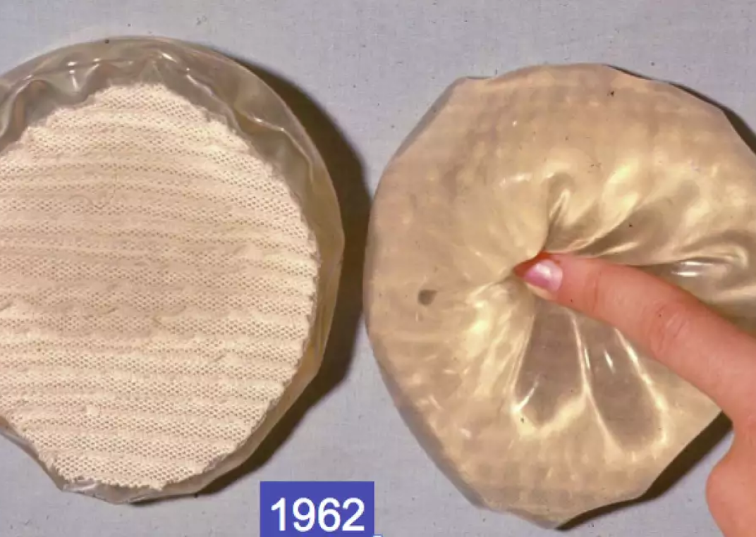 Breast Implants 1962