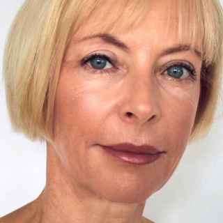 Dr. Ingrid Schlenz, plastic surgeon