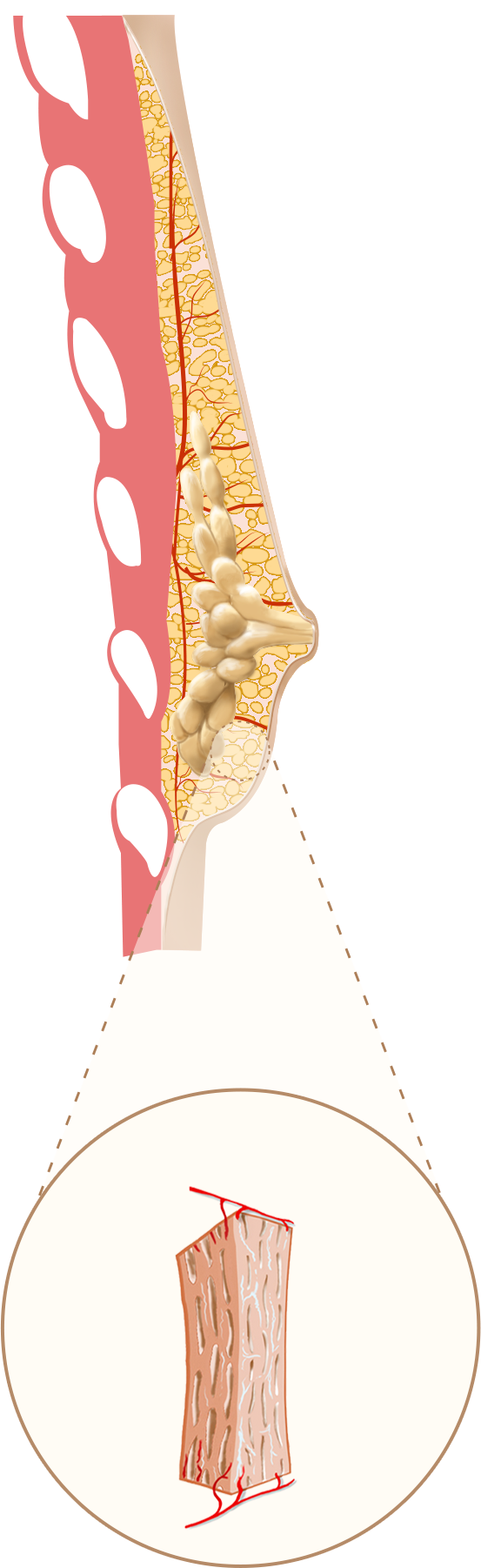 EVEBRA stage one — baseline breast tissue before treatment