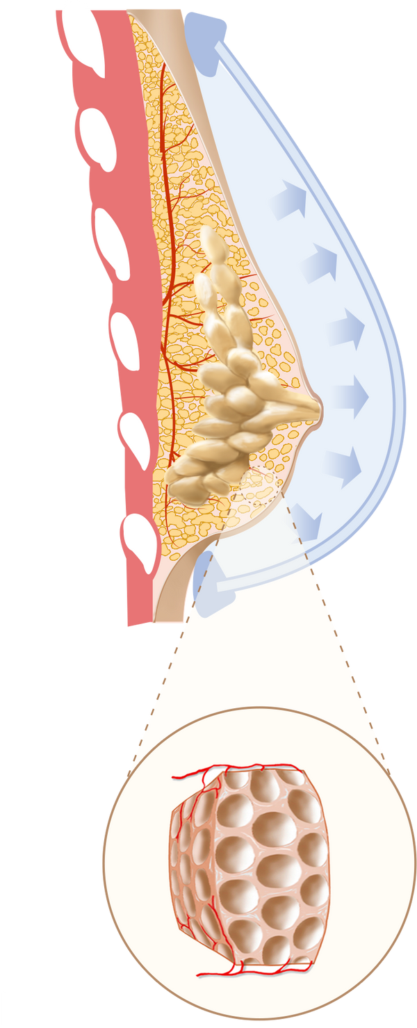 EVEBRA stage two — early tissue response, weeks 0 to 8