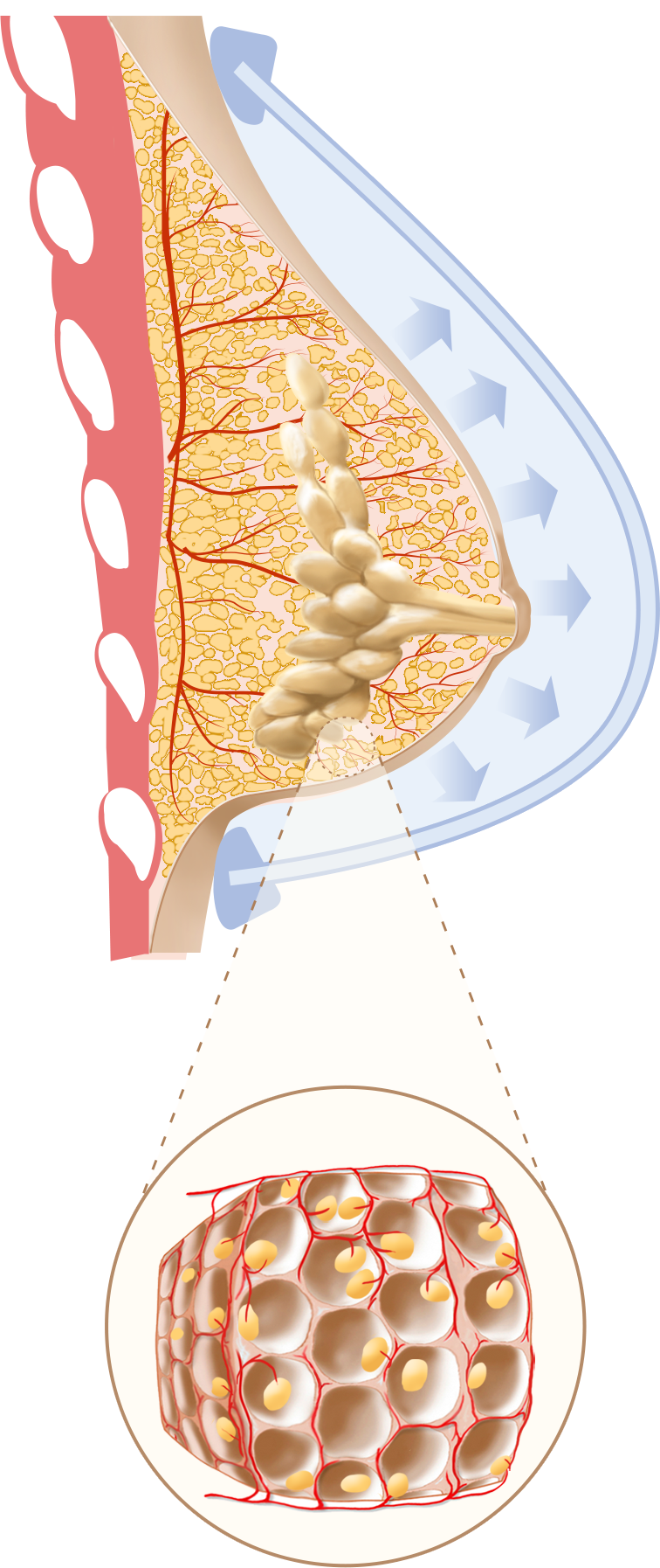 Original EVEBRA stage three illustration showing later tissue adaptation