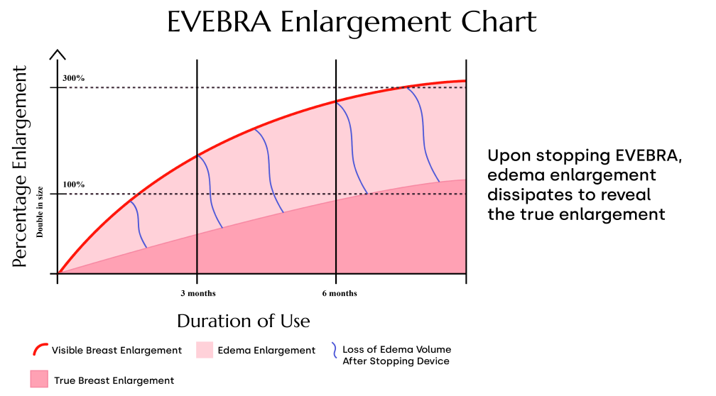 EVEBRA Breast Enlargement Graph