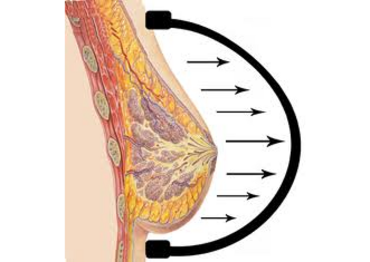 Archival graphic explaining external tissue expansion