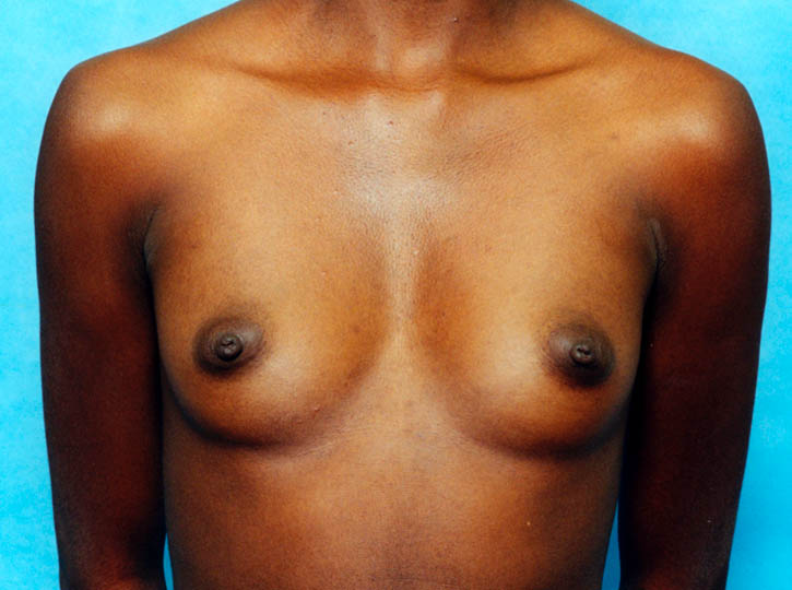 Clinical comparison 19: baseline, first view