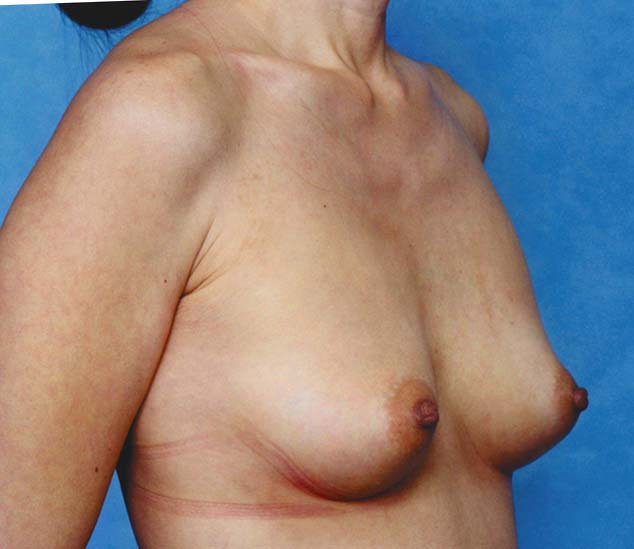Clinical comparison 20: follow-up, second view