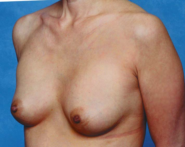 Clinical comparison 20: follow-up, first view