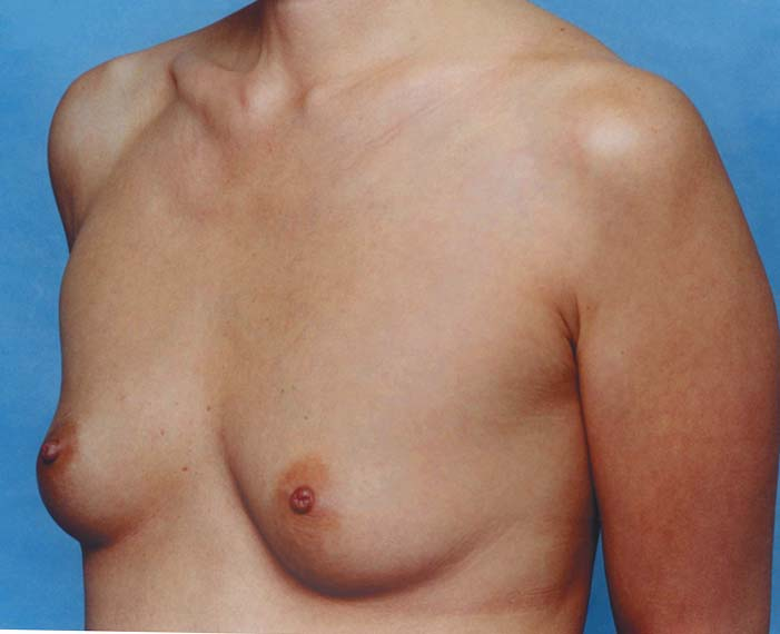 Clinical comparison 20: baseline, first view