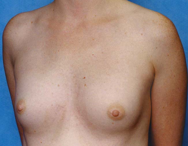 Clinical comparison 22: follow-up, first view