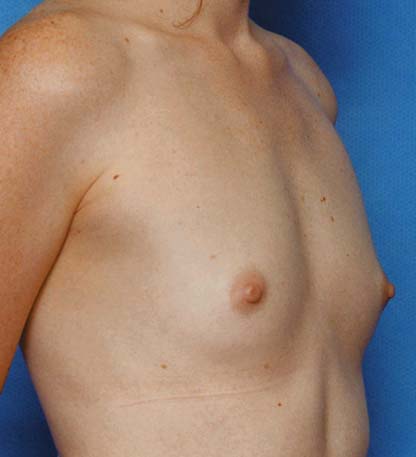 Clinical comparison 22: baseline, second view