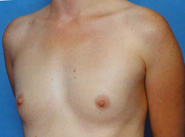 Clinical comparison 22: baseline, first view