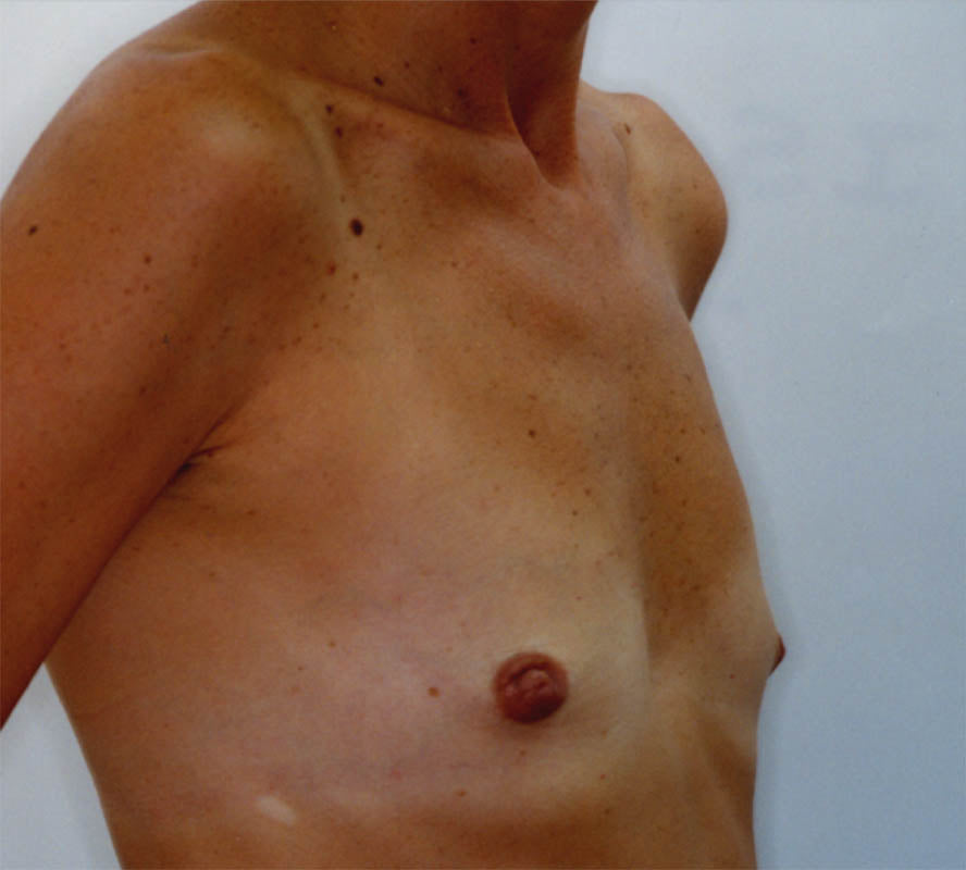 Clinical comparison 23: baseline, first view