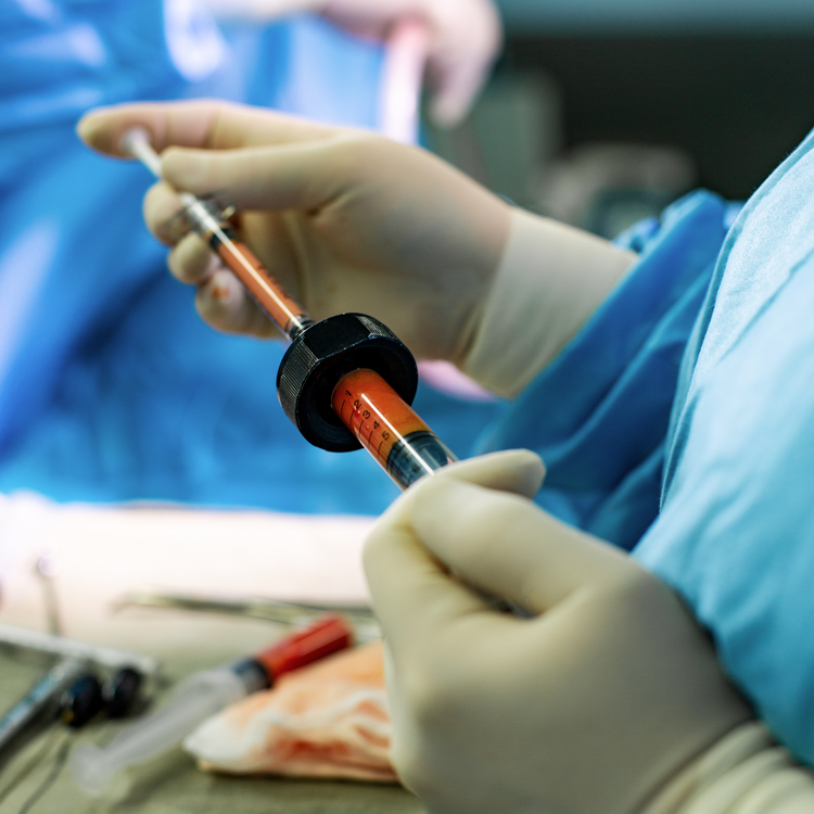 Gloved hands preparing material for surgical fat grafting